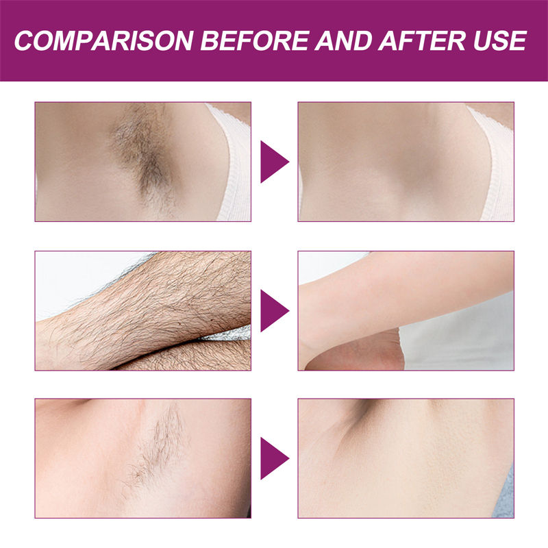 Silky Beauty Spray, Quick and Painless Hair Removal Spray Foam for Legs, Arms, Underarms, Chest, Back, for Men and Women Skin Care 150ml